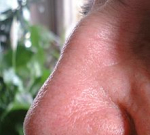 Svědění nosu a kolem nosu