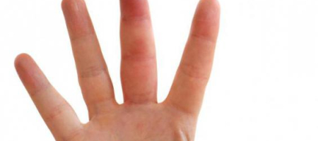 Oteklé klouby prstů na ruce