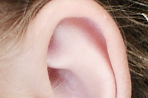 Bolest ucha
