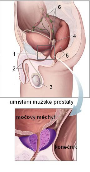 Léčba rakoviny prostaty