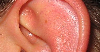 Co znamená pálení uší nebo pálení v uchu?