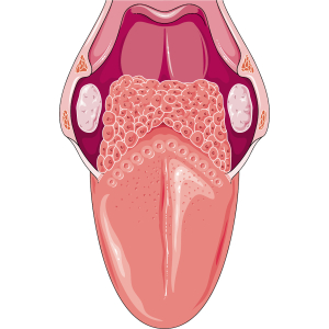 Varovné příznaky rakoviny jazyka