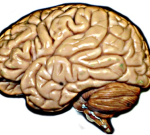 Cévní mozková příhoda