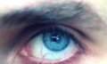 Domácí léčba červených žilek v očích