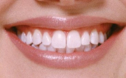 Zubní sklovina