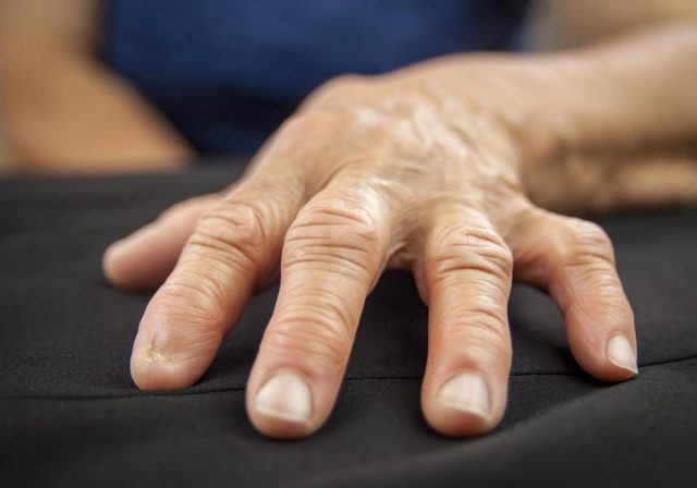 umblă o articulație a genunchiului branțuri pentru artroza articulației gleznei